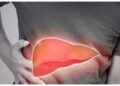 Fatty Liver Cases Surge in Kashmir, Doctors Warn of Silent Health Crisis