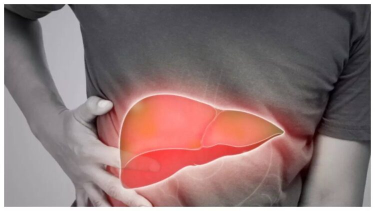 Fatty Liver Cases Surge in Kashmir, Doctors Warn of Silent Health Crisis